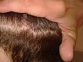 Click image for larger version

Name:	5,8 months - scar-wet hair.jpg
Views:	1400
Size:	94.7 KB
ID:	432332