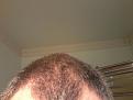 Click image for larger version

Name:	2016HAIRLINE.jpg
Views:	1434
Size:	86.5 KB
ID:	440988