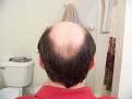 Click image for larger version

Name:	BackHair.jpg
Views:	2052
Size:	97.1 KB
ID:	446357