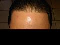 Click image for larger version

Name:	hairline.jpg
Views:	554
Size:	88.2 KB
ID:	448361
