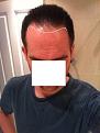 Click image for larger version

Name:	hairline2x.jpg
Views:	910
Size:	30.0 KB
ID:	454463