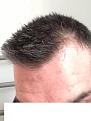 Click image for larger version

Name:	hairline5.jpg
Views:	13655
Size:	85.2 KB
ID:	471591