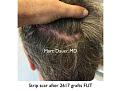 Click image for larger version

Name:	Hair Transplant Slides copy.006.jpg
Views:	240
Size:	19.0 KB
ID:	474859