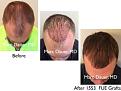 Click image for larger version

Name:	Hair Transplant Slides copy12.002.jpg
Views:	264
Size:	14.8 KB
ID:	475335