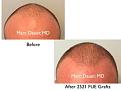 Click image for larger version

Name:	Hair Transplant Slides copy17.001.jpg
Views:	1054
Size:	11.0 KB
ID:	475582