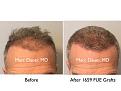 Click image for larger version

Name:	Hair Transplant Slides copy13.001.jpg
Views:	361
Size:	12.9 KB
ID:	478765
