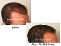 Click image for larger version

Name:	Hair Transplant Slides copy1111.004.jpg
Views:	281
Size:	12.6 KB
ID:	479846