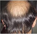 Click image for larger version

Name:	Back_Hair.jpg
Views:	291
Size:	17.0 KB
ID:	485626