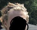 Click image for larger version

Name:	Hairline 2 Years ago.jpg
Views:	130
Size:	77.9 KB
ID:	495276