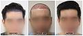 Click image for larger version

Name:	Hairline-Clinic-Forums copy.jpg
Views:	83
Size:	90.4 KB
ID:	499811